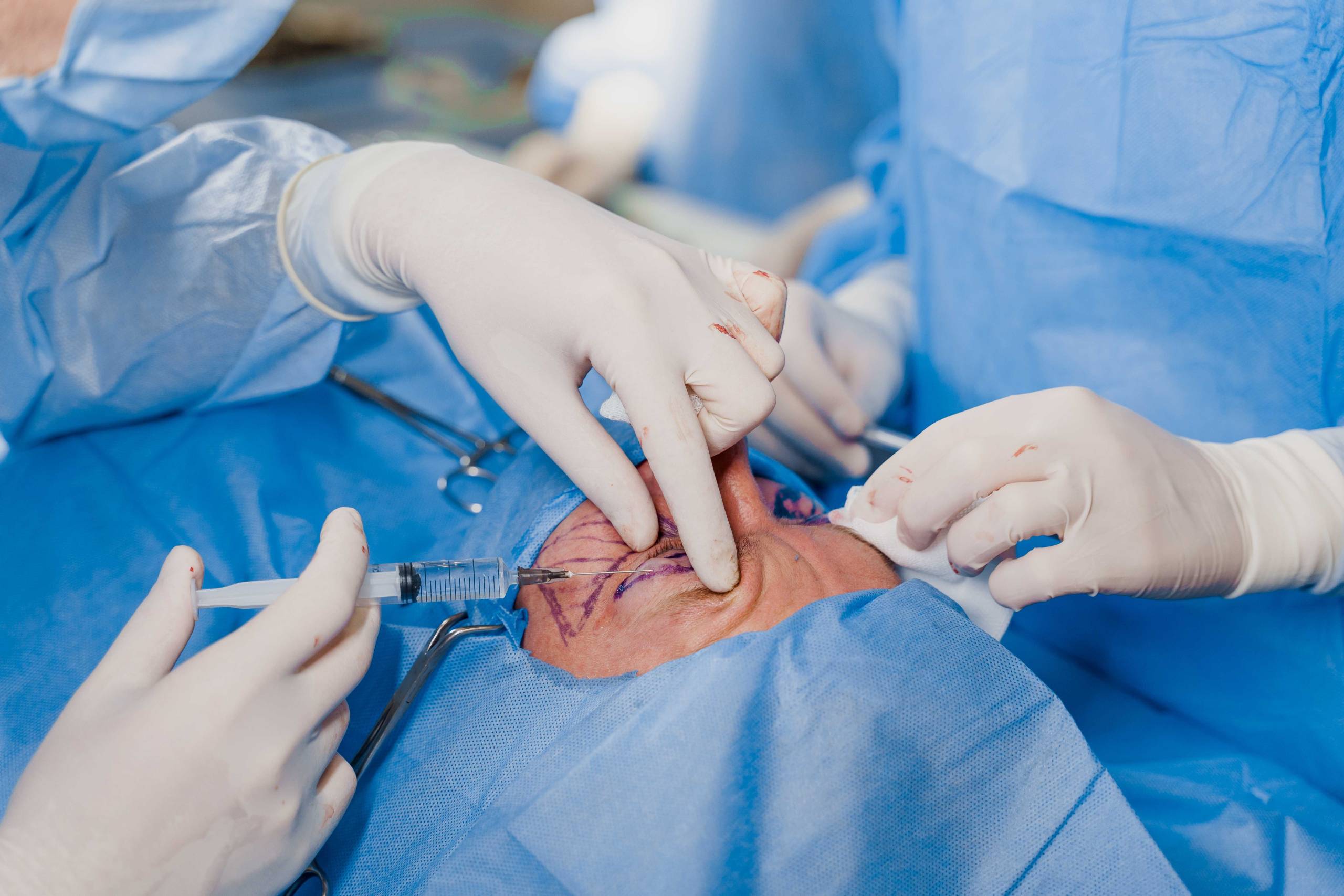 Oculoplasty-Giridhar Eye Institute Oculoplasty-Giridhar Eye Institute