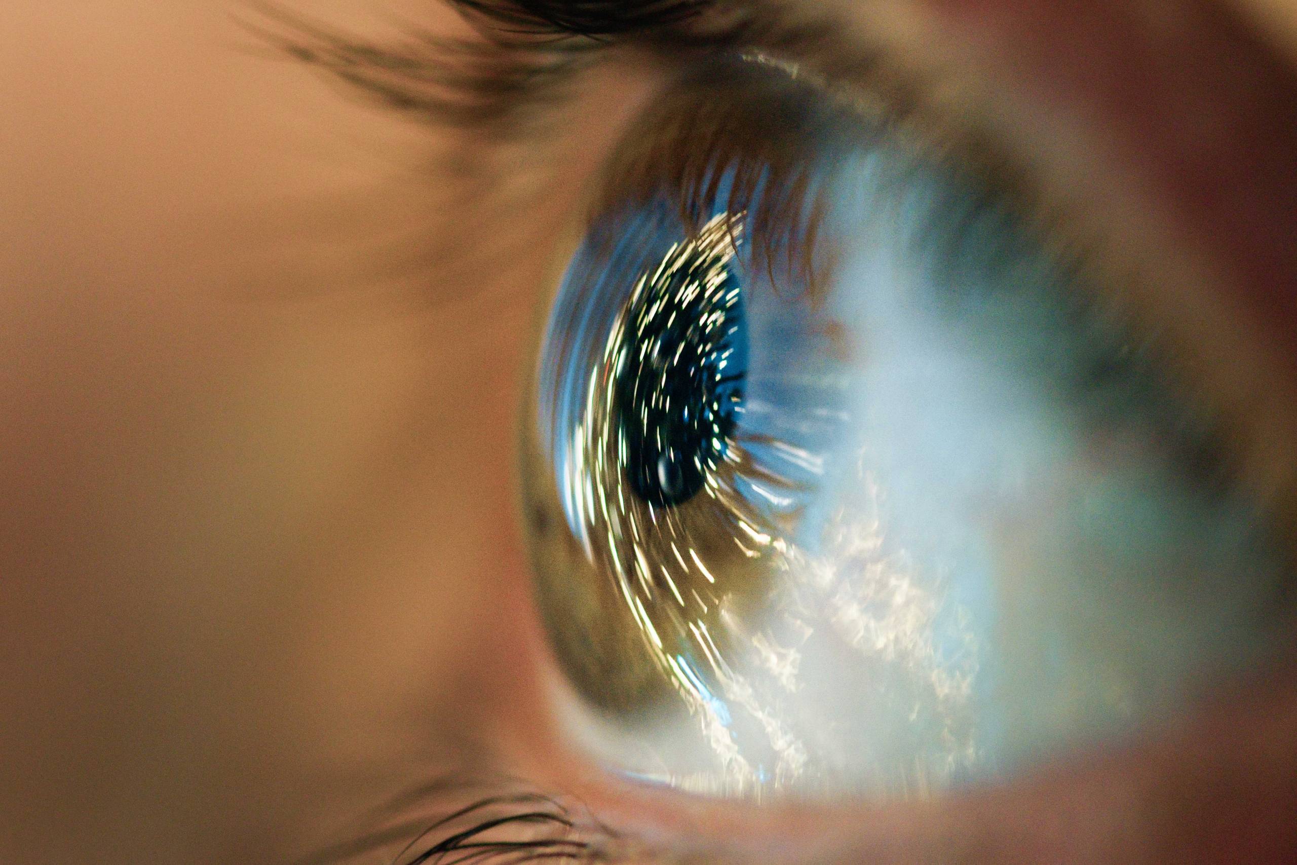cornea-treatment cornea-treatment-giridhar eye institute