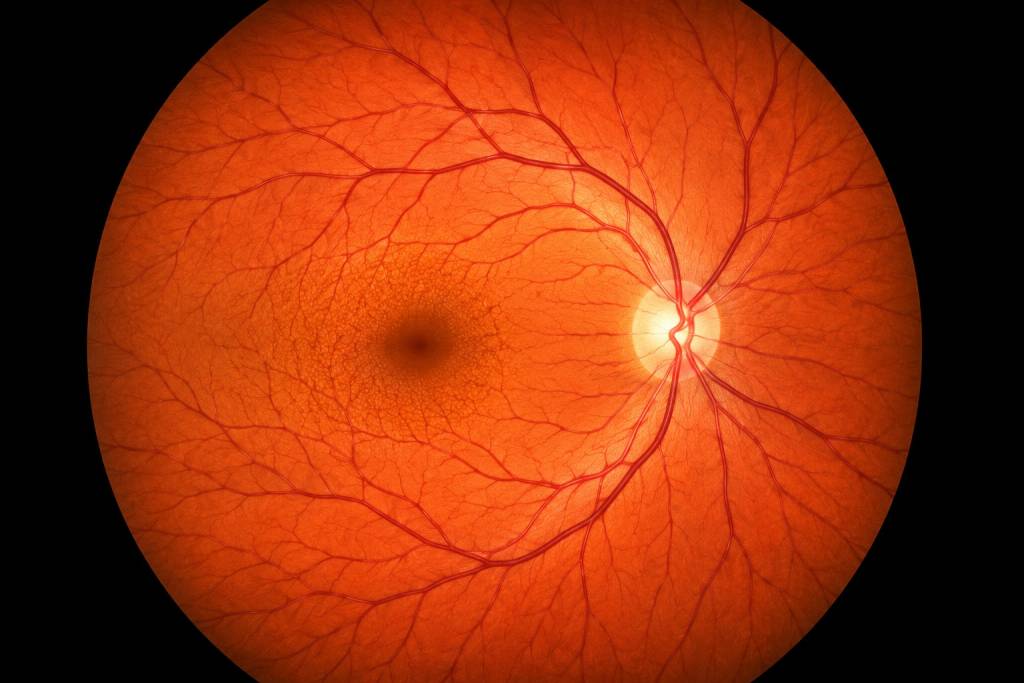 Surgical Retina