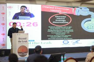 Beyond the Leak – Redefining CSCR in 2026